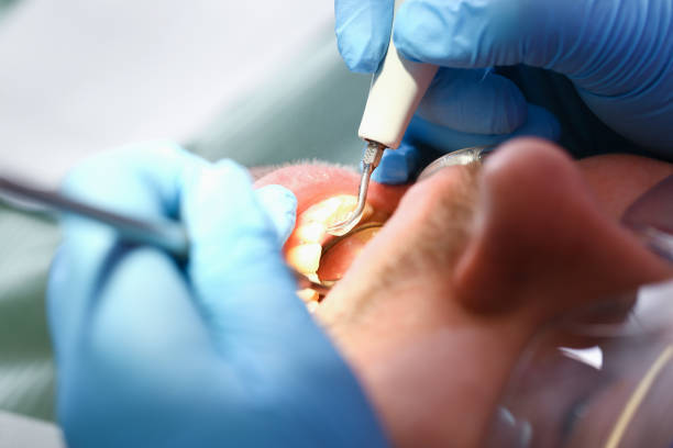 Best After-Hours Dental Trauma Care in Mcdonald, OH