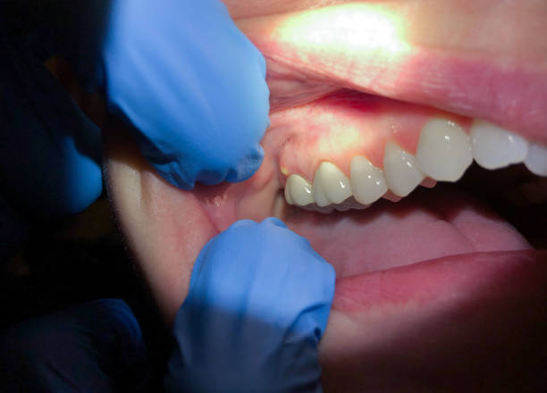 Best Weekend Emergency Dentist in Mcdonald, OH