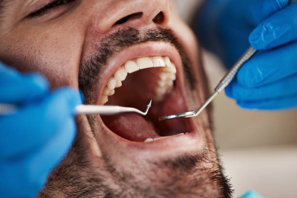 Best Emergency TMJ Treatment in Mcdonald, OH